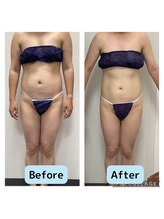 リオンズ 千葉アリオ柏店/3か月で体脂肪率－11%！【痩身】