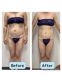 リオンズ 千葉アリオ柏店/3か月で体脂肪率-11%!【痩身】