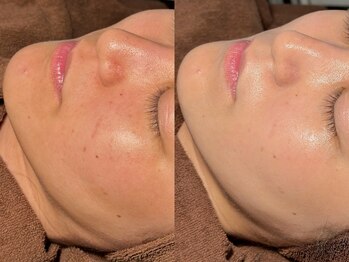 ルーナジェーナ(Luna llena)/池袋　エステ　ルーナジェーナ