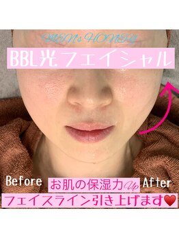 ハニーアイズ(Honey Eyes)/BBLフェイシャル☆