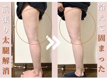 ヨサパーク エム(YOSA PARK 笑)/効果事例