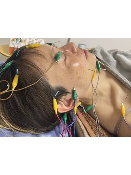 ホウレイ線・たるみ改善！予防ケア