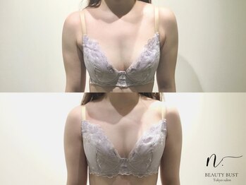 エヌドット 日本橋(N.)/3回モニターで確実に効果を実感