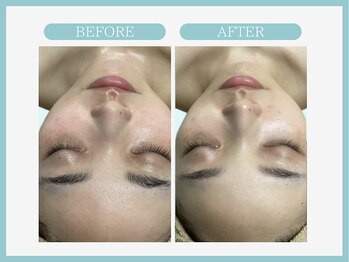 スリムライン 青森店(The Slim Line)/before→after