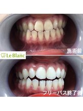 ルブラン 奈良店(Le Blanc)/思い立ったらホワイトニング！
