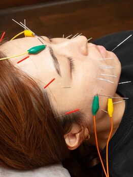 ふなと川接骨院 倉賀野院/美容鍼【群馬　高崎　美容鍼灸】