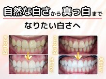 プラチナムビューティ 福山駅前店