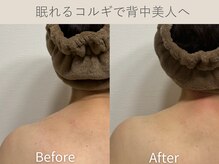 セレソル(CERESOL)/〈70代〉亀クビも改善◎