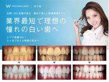 ホワイトニングショップ 米子店