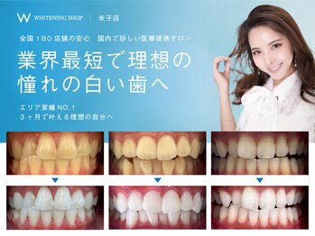 ホワイトニングショップ 米子店