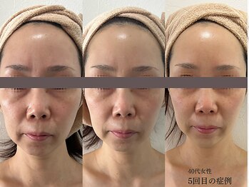 リボーン 柏(REBORN)/【透明感】くすみ印象に終止符を