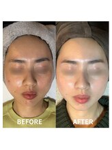 ヴィヴ 三島店(Vive)/《ヒト幹細胞》