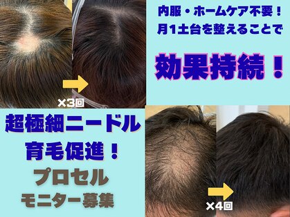 テセラ(Tethere)の写真