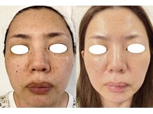 ワッカ(wacca)/まぶた・唇まで全て