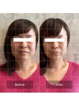 フフラ KANコルギセラピー山梨本店(fufla)/骨気　小顔ソムリエ