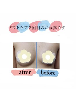 そらまめ/バストケア３回目です