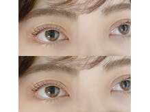 ダブリューアイキャンディー(W eye candy)