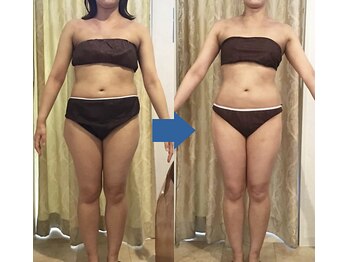 ピュアトゥルー 岐阜西店(PureTrue)/余分なお肉に高周波！ラジオ派！