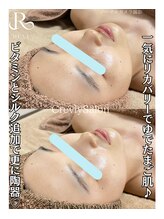 クレヴィー(Creviy)/陶肌トリートメント1回の変化