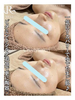 クレヴィー(Creviy)/陶肌トリートメント1回の変化