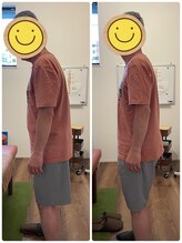 はた整体院/辛い腰痛の整体後