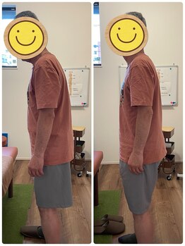 はた整体院/辛い腰痛の整体後