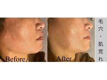 ブラックボックス(BLACK BOX)/東海村K様40代