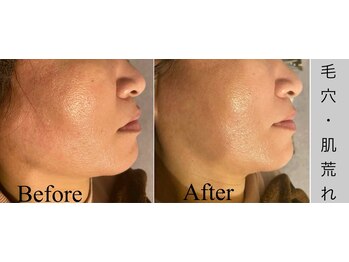 ブラックボックス(BLACK BOX)/東海村K様40代