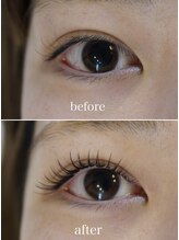 リーナ(r:na)/&healthy+ブラウンエク140本