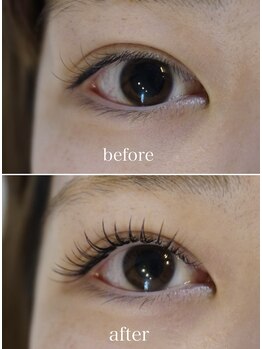 リーナ(r:na)/&healthy+ブラウンエク140本