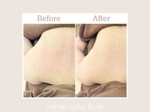 トータルビューティー ゆみえエステ(Total Beauty)/