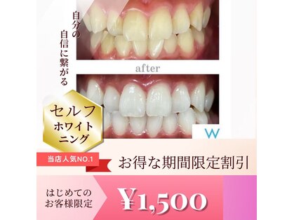 ホワイトニングショップ 町田店の写真