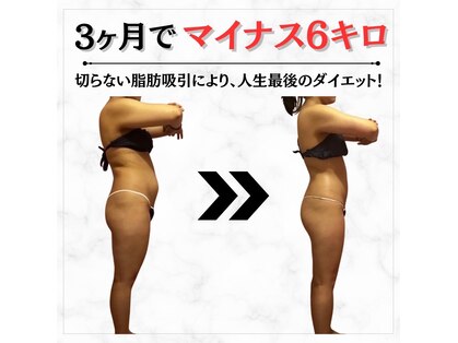 ディタ アンド ボーン(DITA&BORN)の写真