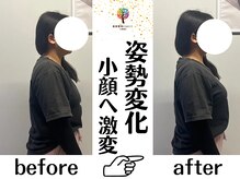 クレスト(CREST)の雰囲気（BeforeAfter！姿勢変化でよりお顔が引き上がる！理想の美姿勢！）