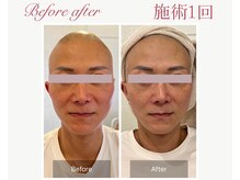 パルタージュ 三宮(Partage)/メンズフェイシャル