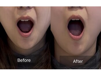 プライミー(PRIMY)/歪みの正体は「顎関節」