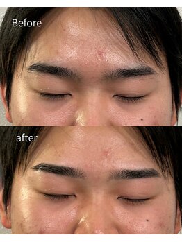 プラチナムブロウ 新潟(PLATINUM BROW)/美眉スタイリングのお客様（20代