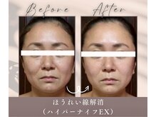 ドクタービラボ 錦糸町(Dr.Vilabo)の雰囲気（優良認定店★お客様の悩みにアドバイスできるサロン）