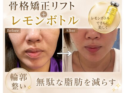カエラ(KAELA)の写真
