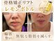 カエラ(KAELA)の写真