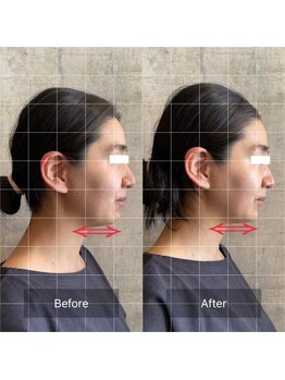 フフラ KANコルギセラピー山梨本店(fufla)/骨気　小顔ソムリエ【小顔】