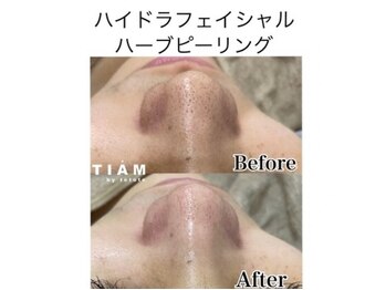 ル ポム バイ ティアム 神戸元町(Le pom by TIAM)/毛穴洗浄+ハーブ