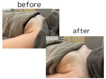 リア(Lia)/konomi式リンパケアオプション!