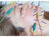 【プレミアム美容鍼×ヘッドスパ】たるみ改善×頭皮コリ緩和♪ ¥9350→¥6050
