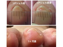 あし処 トコトコ(tocotoco)の雰囲気（【巻き爪、肥厚爪など】爪のお悩みご相談ください！）