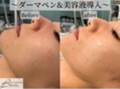 ベル 柏(Belle)の写真