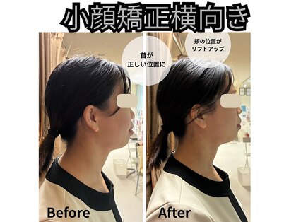 フェイエール鍼灸院 ラスィーヌ(fier鍼灸院 racine)の写真