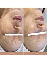 ルルーディア(LOULOUDIA)/サロンケア＋ホームケア最短◎