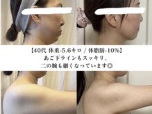 痩せる汗をかいてぎゅぎゅっと全身引き締めダイエットはお任せ☆