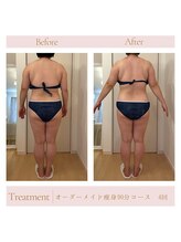 エミル(Emillu)/＊Body_ビフォーアフター